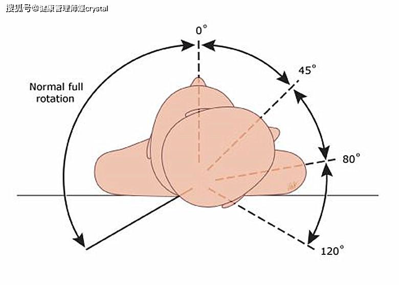 「健康管理师媛crystal」辟谣：孩子脖子歪就是头颈有问题？还有2个原因，家长别忽视