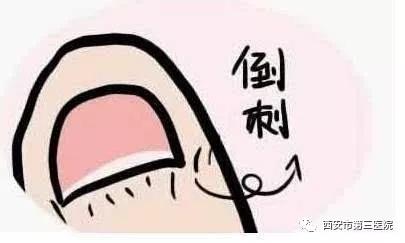 西部资讯：【育儿知识】宝宝手指出现倒刺是缺什么吗？