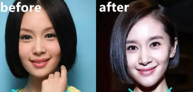 方脸怎么变成小脸型 20ff1d600b6e4c0d9ed65999133642b9.jpeg