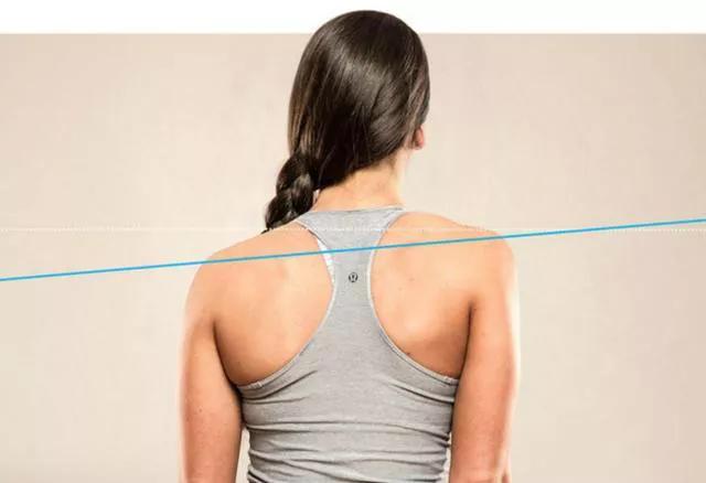 如果从正面看有双肩不等高或后面看到有后背左右不平,就应怀疑脊柱侧