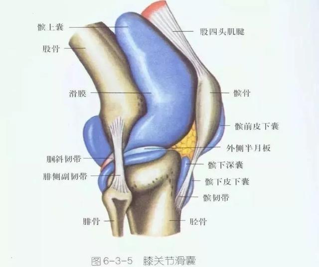 ①肿胀的,膨大的滑囊在膝关节的前部出现; ②经常有重复的剪力施于膝