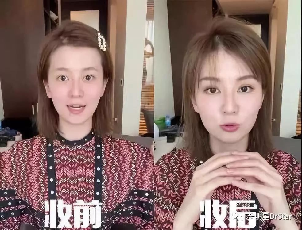 乔欣眼睛大变样,莫名不像本人了是怎么回事?