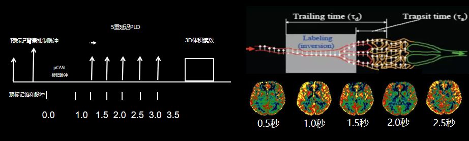 软件试用| 无创脑灌注定量成像3d-asl后处理