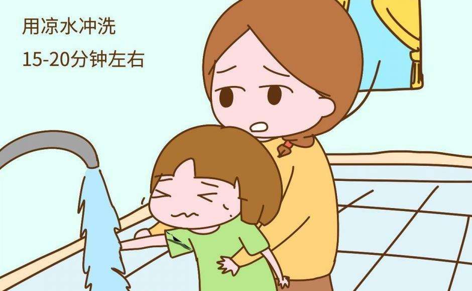 怎样防止小孩被烫伤 9edb4129f427461394c018d8c0f3e794.jpeg