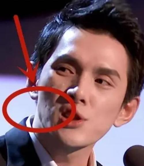 李佳琪脸上坑坑洼洼,素颜照不堪入目,口碑消耗光后只有脱粉!