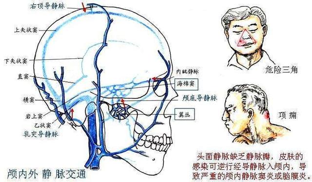 注射美容的的安全性,为何注射类美容严重的会导致失明?_栓塞