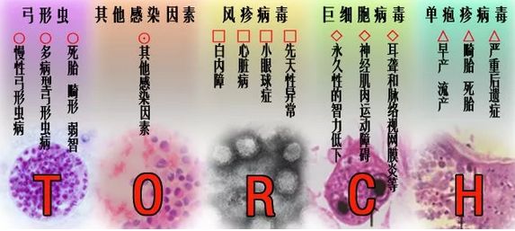 已经做了婚检，还有必要做孕前检查吗？