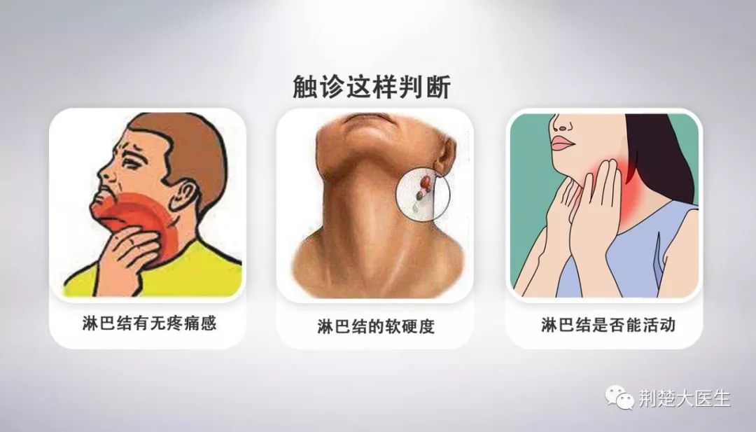 (1)颈部淋巴结,要从耳后到耳前到颌下,用指腹顺着摸下去.