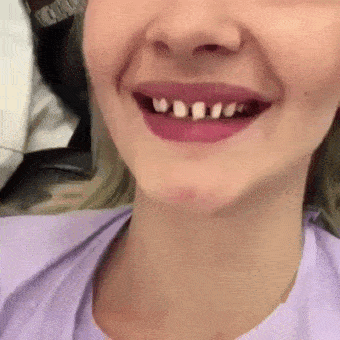 爆笑GIF趣图: 听说, 很多明星的牙齿都是这么弄的? _段子