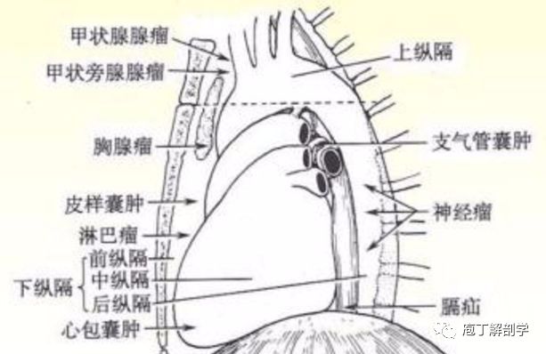 纵隔解剖   纵隔疾病x线诊断要点