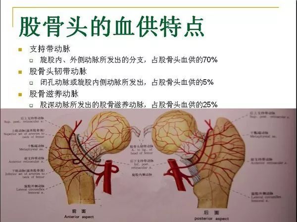 患者注意股骨头坏死后盲目止痛会加重病情