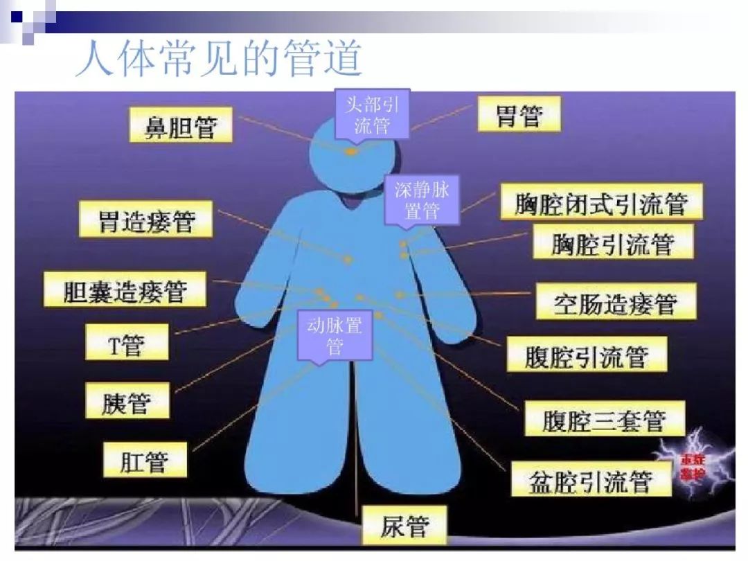 优秀ppt——外科管道护理中的细节管理?你做到位了吗?