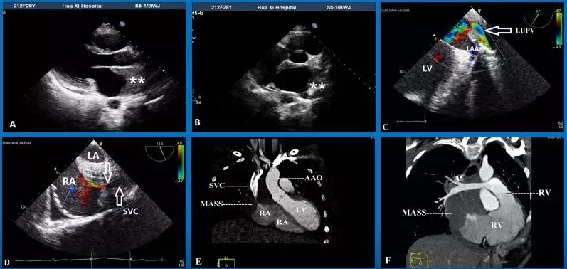 超声心动图十大基本功5.1:为什么要教临床医生解读超声报告?