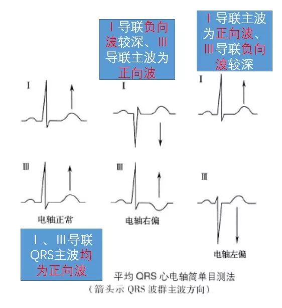 心电图"零"基础入门,干货满满!