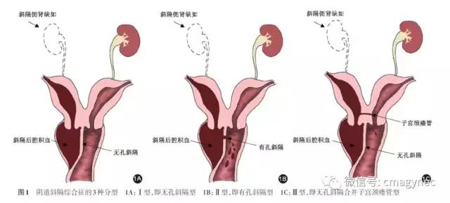 14岁少女痛经三年不得不辍学竟是因为这种病