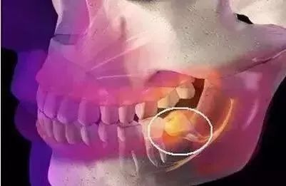 多少岁不会再长智齿 68d55413817344b783aad0addefb889a.jpeg