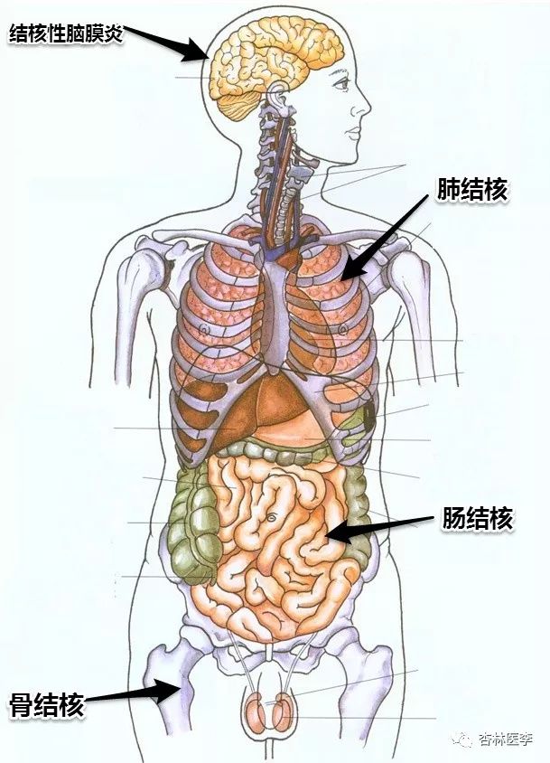 结核菌人口_结核菌素试验阳性图片(2)