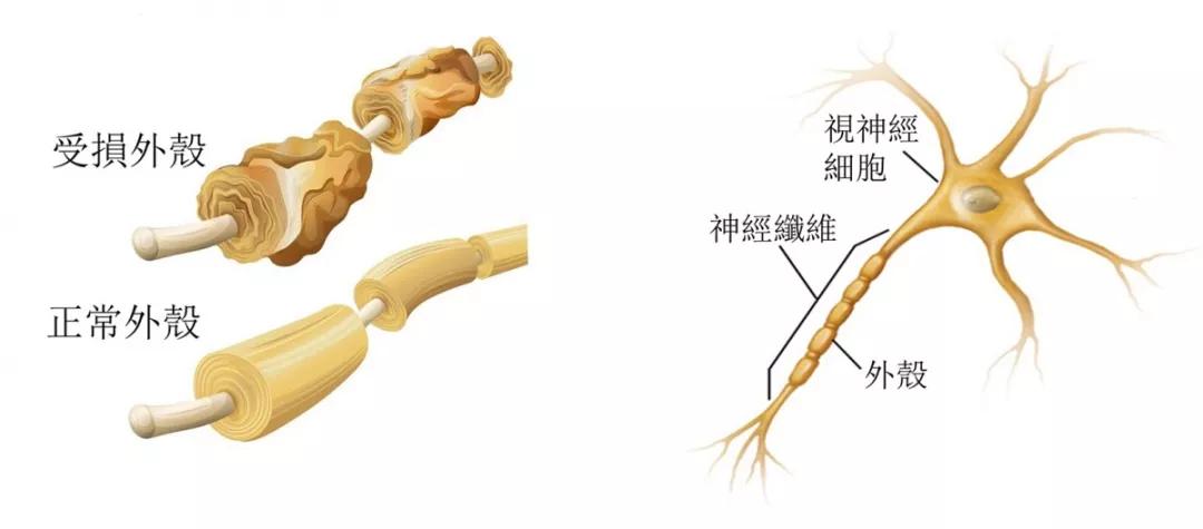 年底冲业绩要注意,小心身体这个部位先告急!