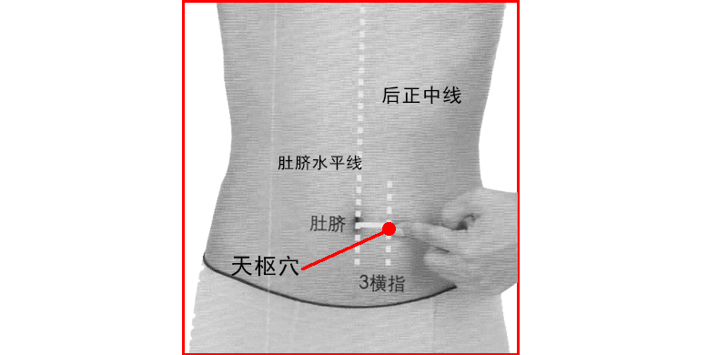 灸法:温熨定灸—10-15分钟.温刮:刮拭按揉天枢穴1-2分钟.