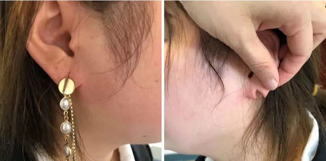 啥时候打耳洞是最好的季节 03396e32bf8d456c8909fb0f795bc57e.jpeg