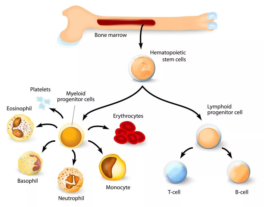 造血干细胞移植_自体造血干细胞移植_微信公众号文章