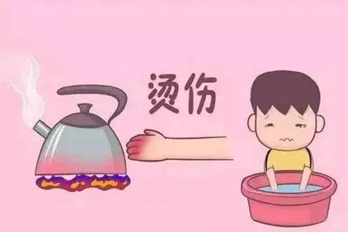 烧伤怎么处理好得比较快 34a73e8feb534876bfc2cf9bab53a377.jpeg