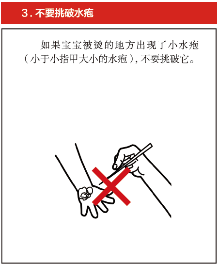 宝宝呵护：家里这个地方最危险，一不小心就会要了孩子命！