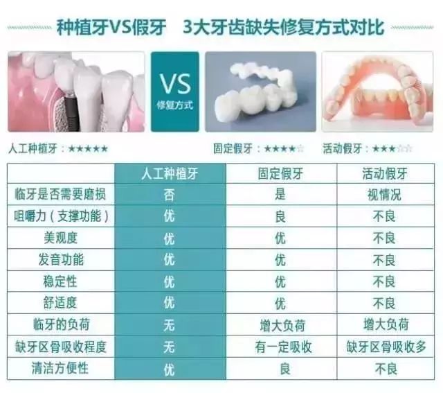 种植牙pk传统假牙,没有对比,就没有伤害