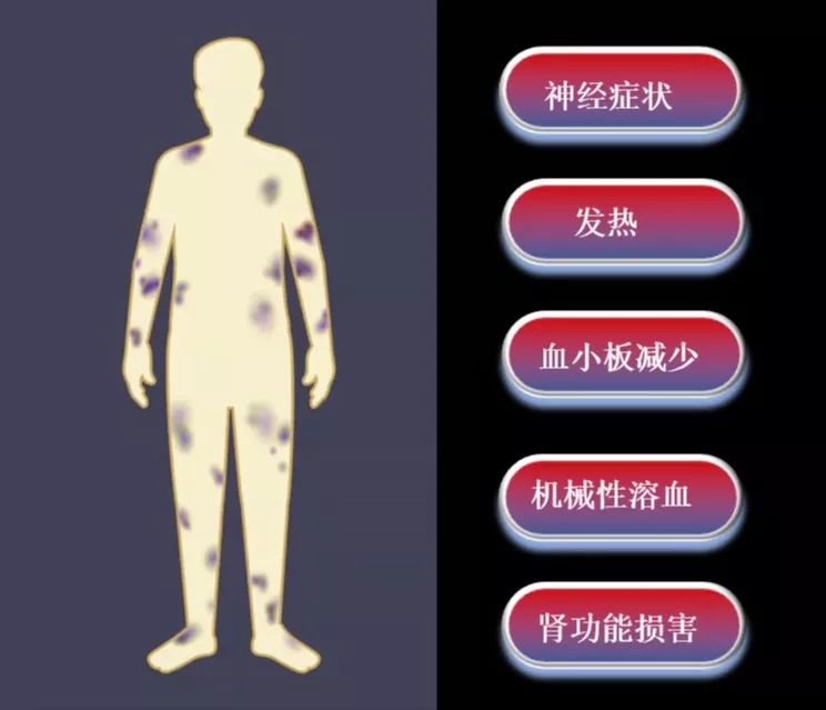 7f577a207d554e2791697b32d1a3453b.jpeg