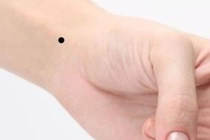 比较大的痣还能消掉吗 810c2188e78345d29e11325b8a57a948.jpeg