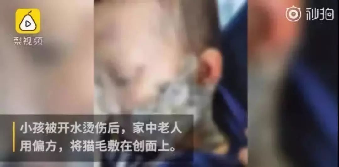 宝宝呵护：家里这个地方最危险，一不小心就会要了孩子命！