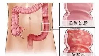 什么食物能修复神经 15f0646a8c9146f49abc8846f5b443a5.jpeg