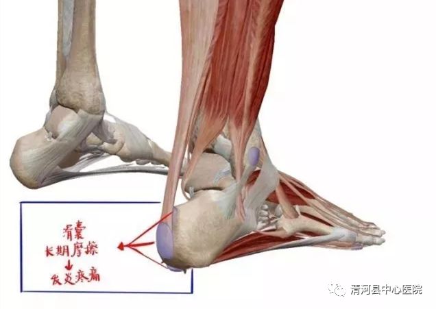 走路脚跟疼!教你几招,"脚踏实地"不再难!