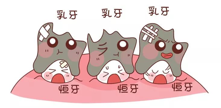 育儿丨出牙晚?怕蛀牙?影响孩子一辈子的乳牙问题得重视!