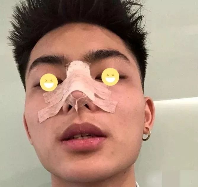 什么样的鼻头是大鼻头 bab66a94415c4cdeba4359948c7e57fe.jpeg