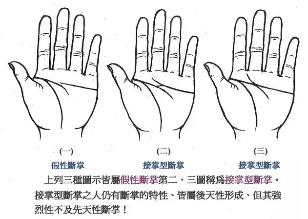 万中无一的断掌你有吗