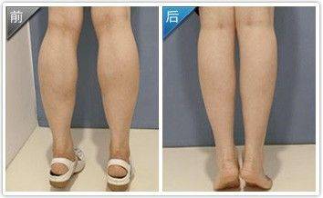 如何拉伸小腿让小腿变瘦 e1e03560fe784e009c9f1e08d3c94d5d.jpeg