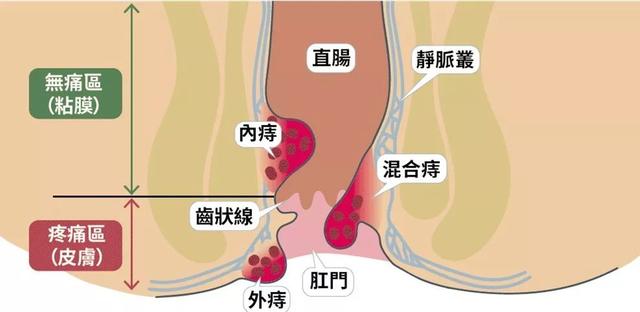 肛门人口_人口普查(2)