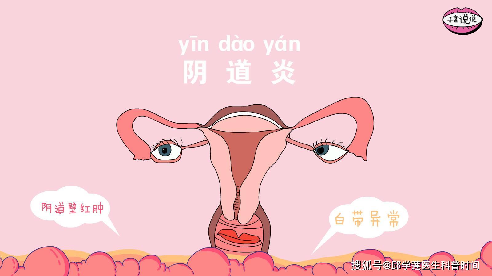 不少女性都知道了,阴道炎一般由真菌,细菌,滴虫引起,但女性对洗浴