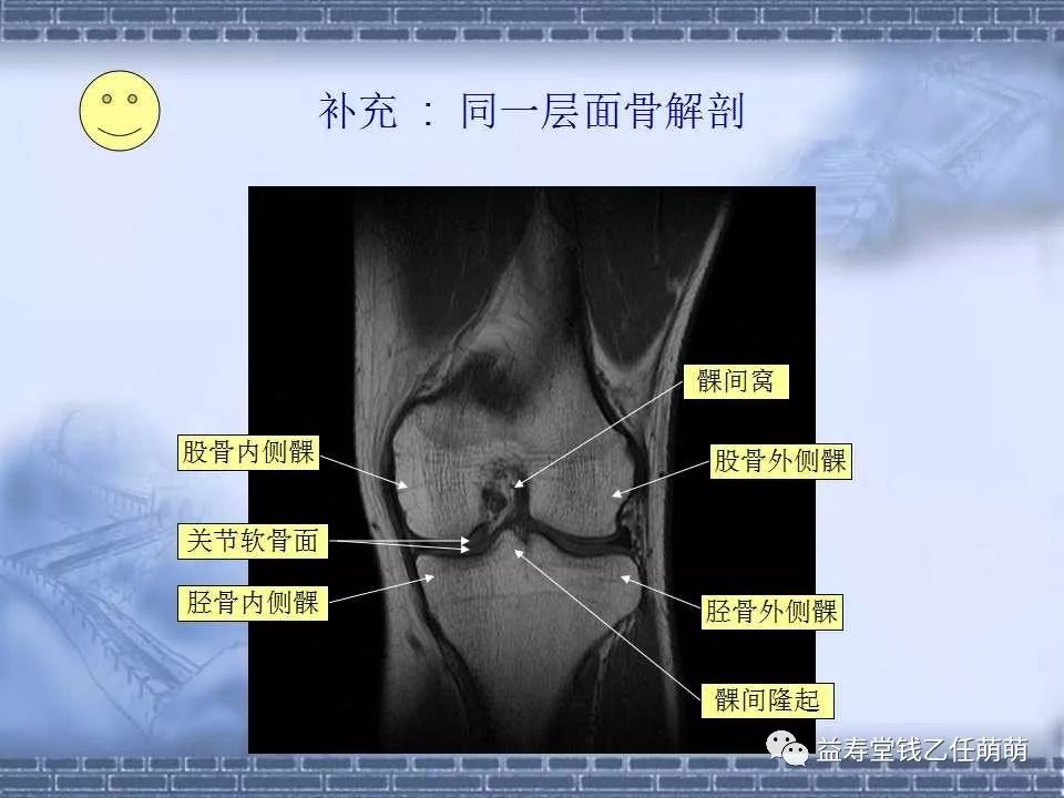 膝关节解剖讲解