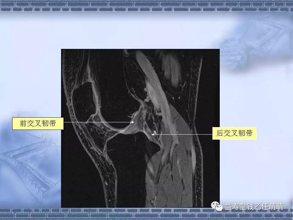 膝关节解剖讲解