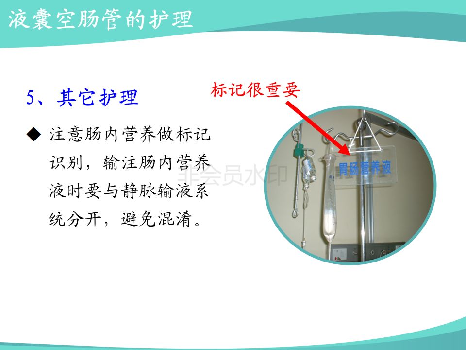 ppt重症胰腺炎患者肠内营养治疗的方式与护理