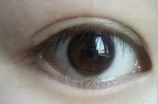 睫有什么成语_双睫症有什么危害