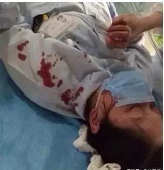 杀医伤医是底层互害的激化