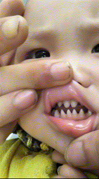 搞笑gif动图：这孩子的牙齿怎么长得这么有个性呢？有点吓人啊 _鱼价