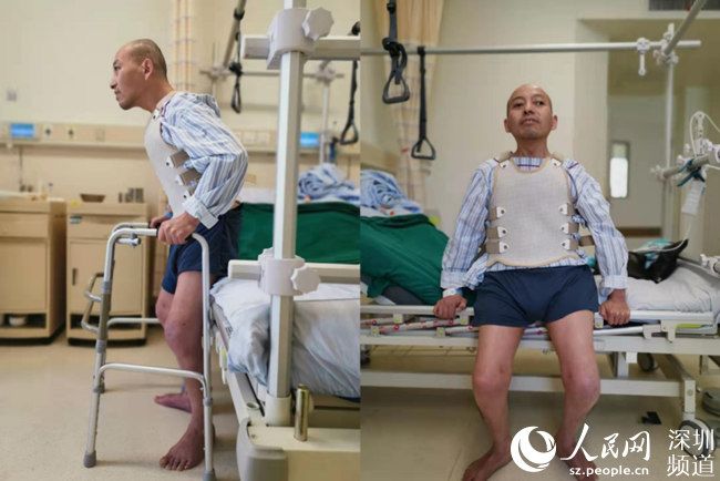 男子折叠28年，如今终于能站着活下去！
