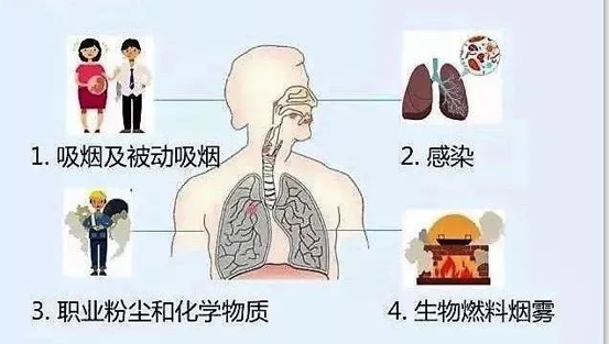 冬季慢阻肺高发 学会这些让呼吸自由起来_治疗