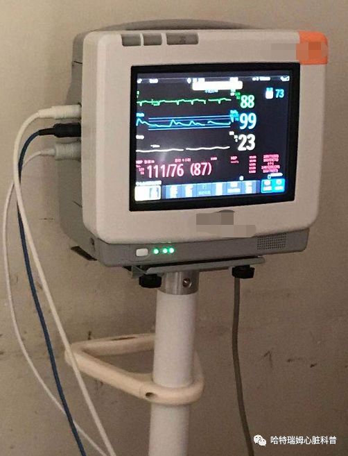床旁监护仪常可记录心律,血压,呼吸频率,还可以通过对手指的氧合检测