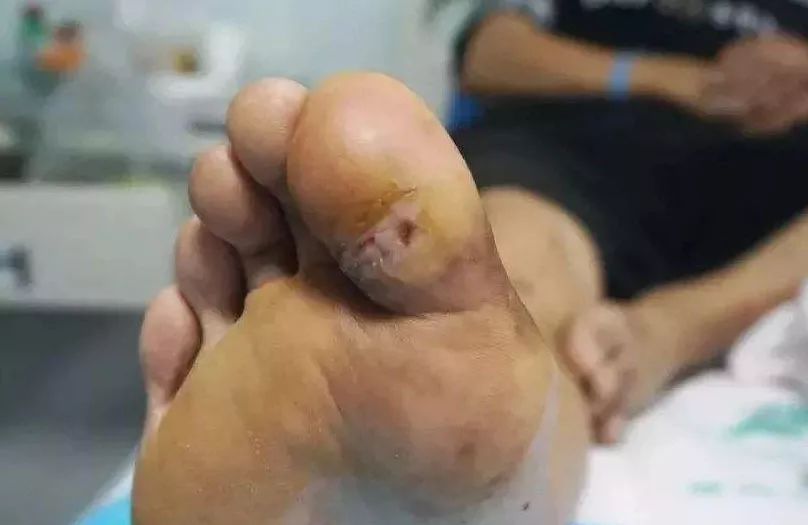 吃什么腿比较有力气 25ae20eb514d47cd9f5ea7f754145aca.jpeg