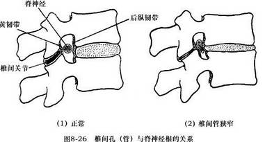 腰椎解剖图基础